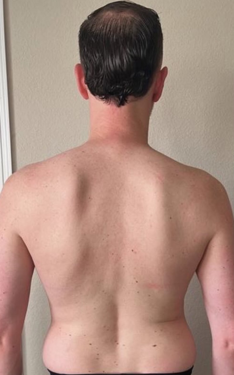 Client 4 before coaching